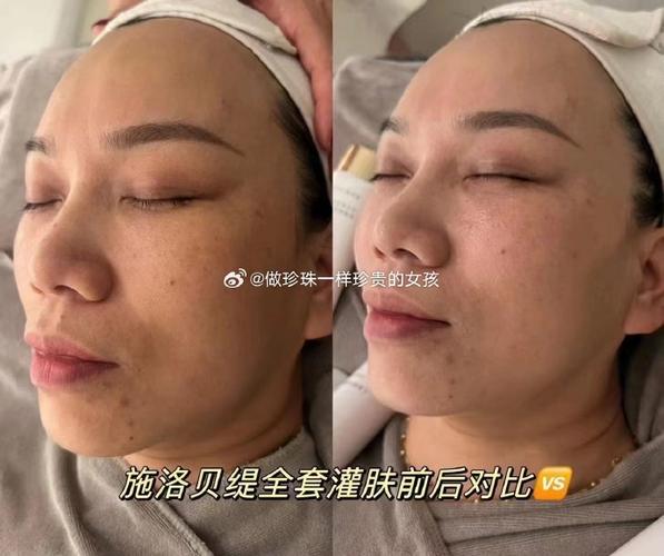 美容院产品嫁接新趋势 施洛贝缇珍珠膏如何提升护肤服务品质